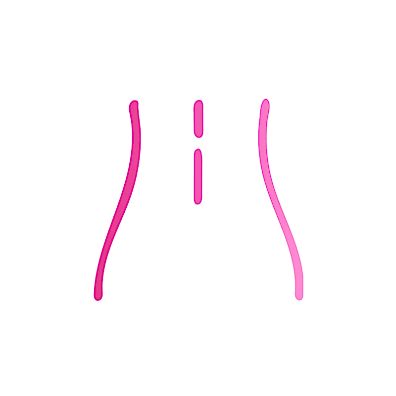 Лазерная эпиляция поясницы