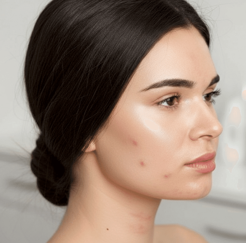 Уход для проблемной кожи