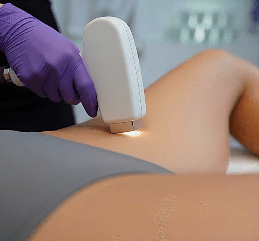 Эпиляция волос