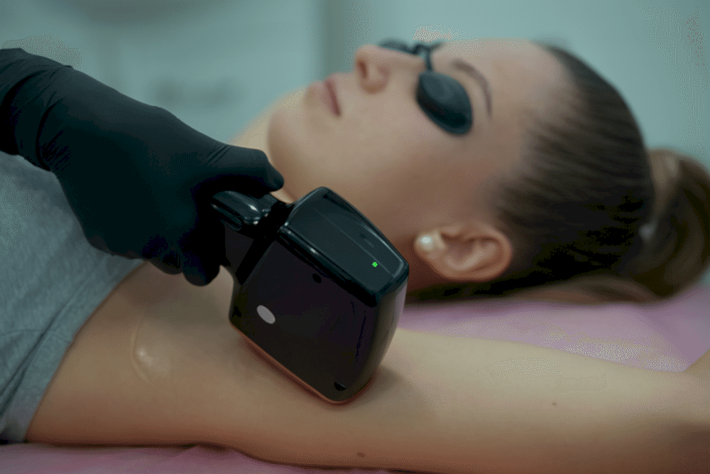 Эпиляция волос