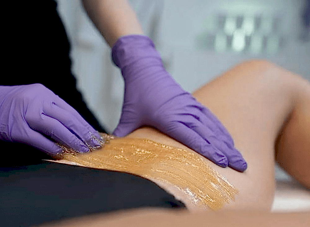 Эпиляция глубокого бикини