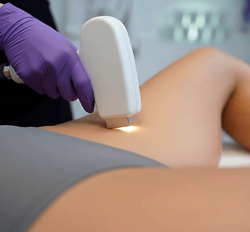 Эпиляция глубокого бикини