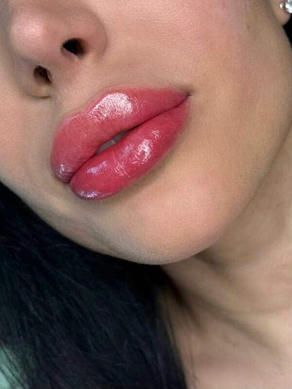 photo-5474297794756998202-y