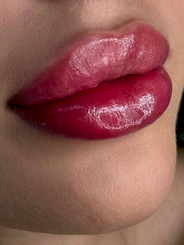 photo-5474297794756998203-x