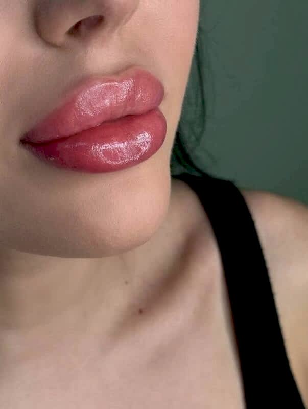 photo-5474297794756998228-y